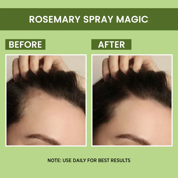 Orignal Rosemary Water, Hair Spray For Regrowth [Buy 1 Get 1 Free]