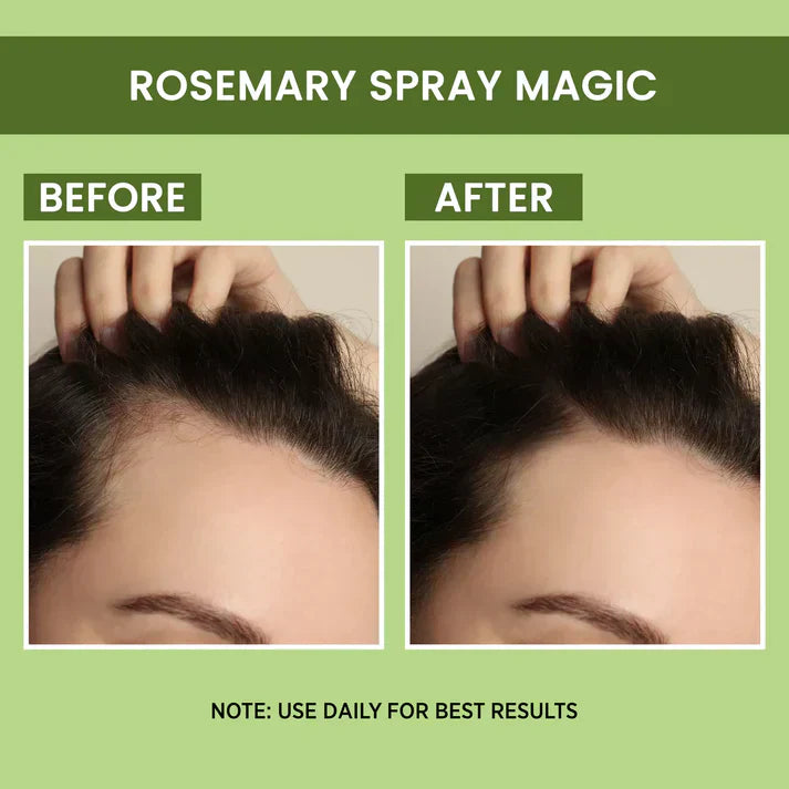 Orignal Rosemary Water, Hair Spray For Regrowth [Buy 1 Get 2 Free]