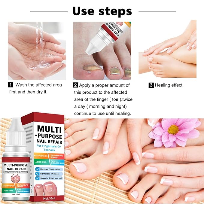 Buy 1 Get 1 Free Nail Repairing Serum For Complete Nail Protection