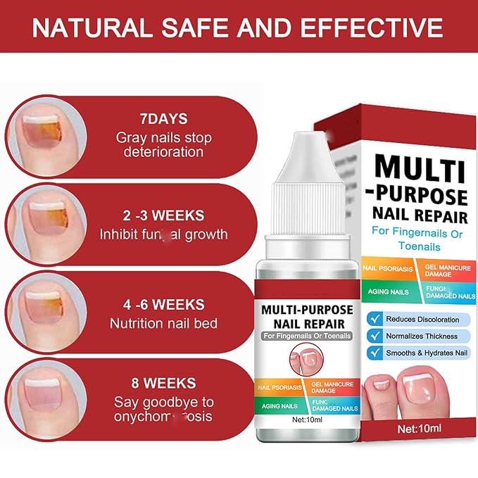 Buy 1 Get 1 Free Nail Repairing Serum For Complete Nail Protection