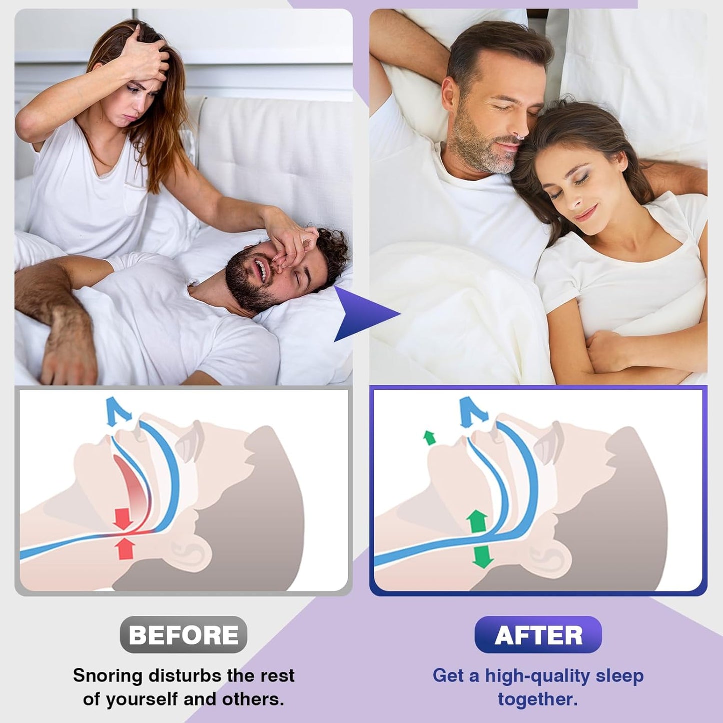 Better Sleep Magnetic Nose Clips Buy 1 Get 1 Free - Snore-Free Sleep Solution for Men and Women