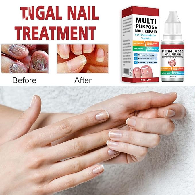 Buy 1 Get 1 Free Nail Repairing Serum For Complete Nail Protection