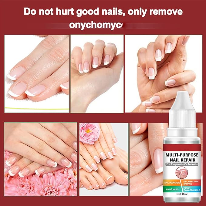 Buy 1 Get 1 Free Nail Repairing Serum For Complete Nail Protection